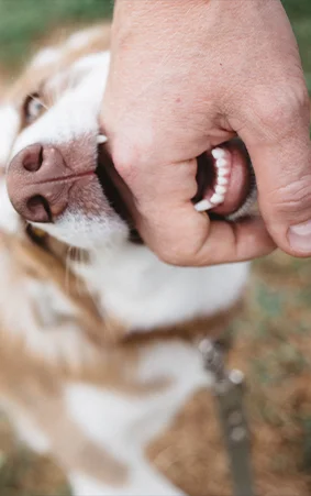 Dog Bites<br> & Animal Attacks