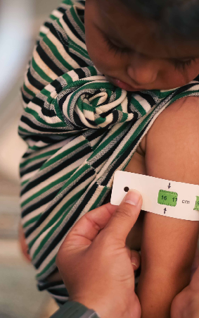 Malnutrition,<br>  Dehydration & <br> Death