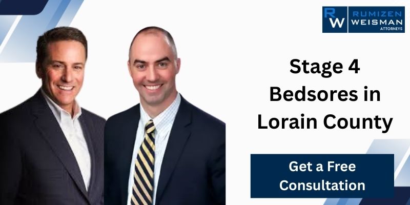 Stage 4 Bedsores in Lorain County: Why This is Automatic Grounds for a Lawsuit